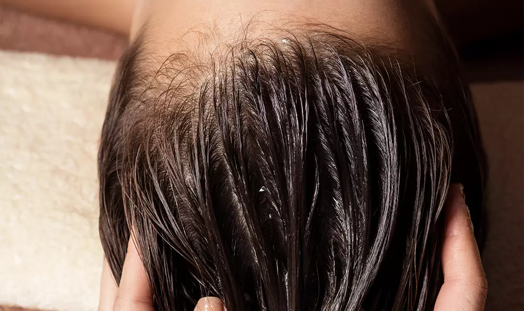 What Does a Healthy Scalp Look Like?